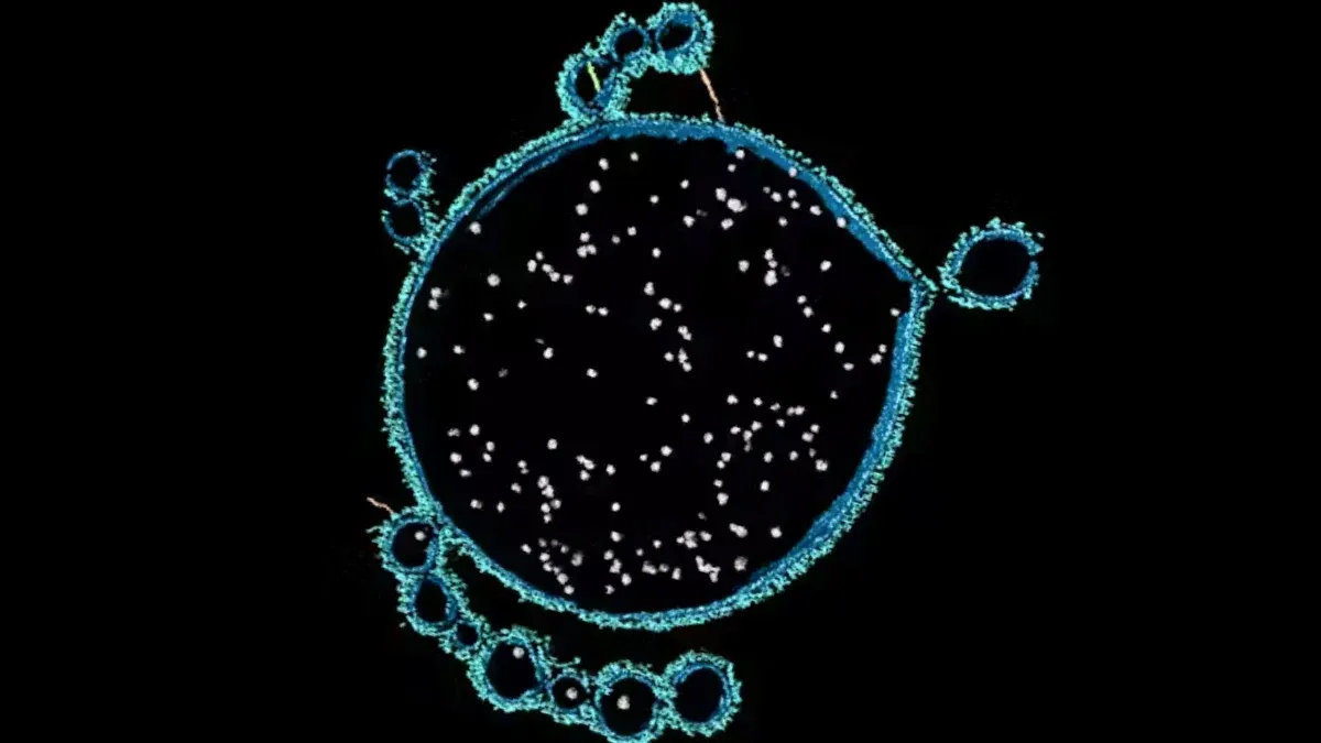 新たに発見された奇妙な微生物が、複雑な生命の起源を解明する手がかりとなるかもしれない