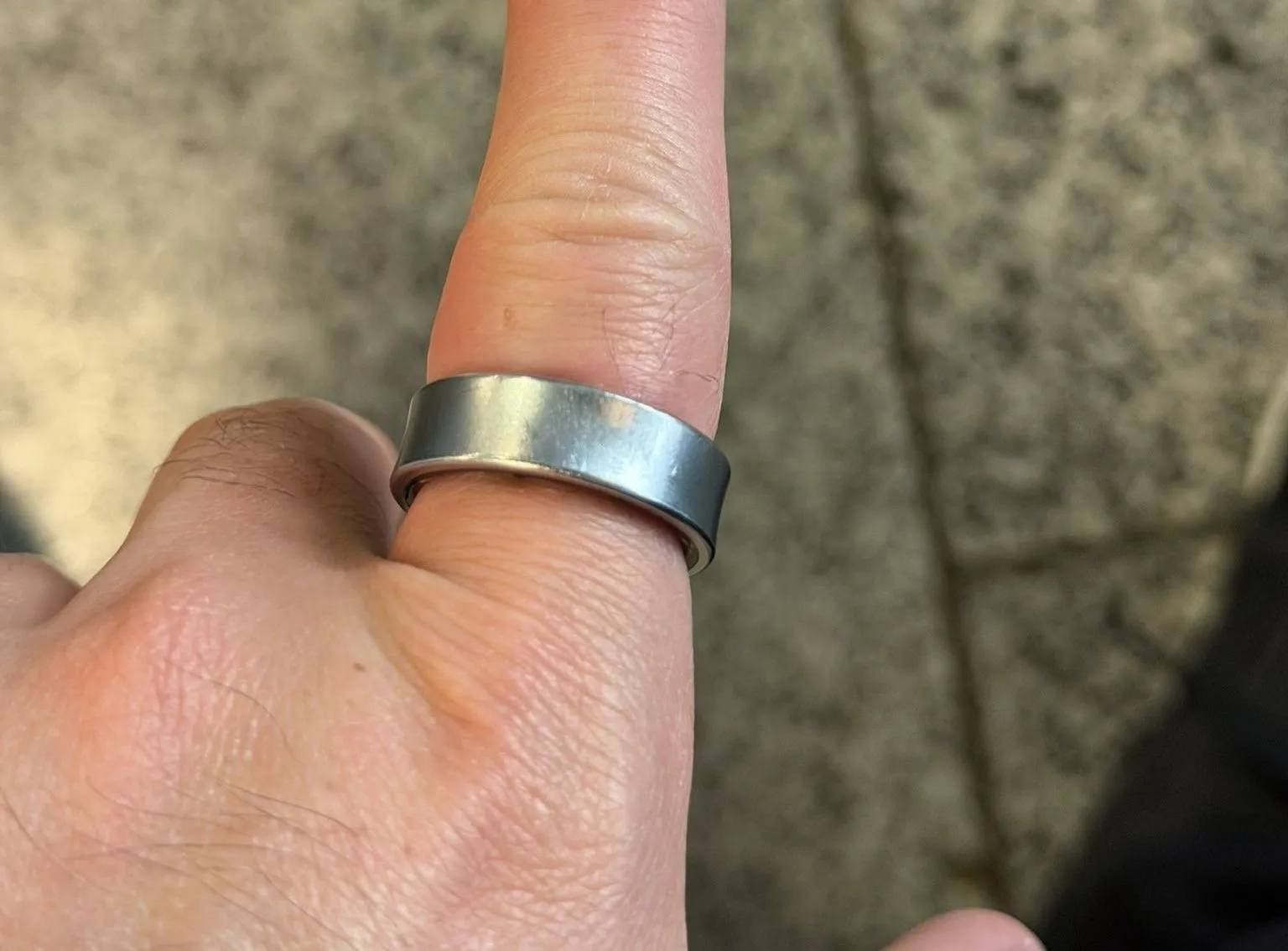 Galaxy Ringバッテリー膨張、指から外れず病院へ。悪夢の全貌