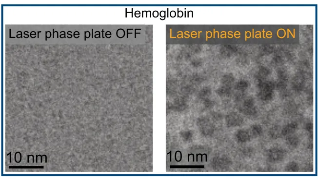 hemoglobin.webp