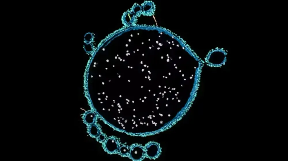 新たに発見された奇妙な微生物が、複雑な生命の起源を解明する手がかり