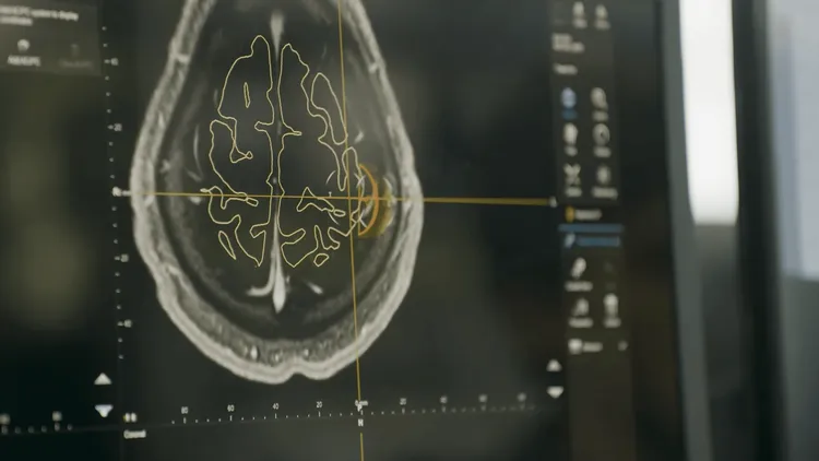 Neuralink、評価額90億ドルで6.5億ドル調達：脳とAIの融合加速