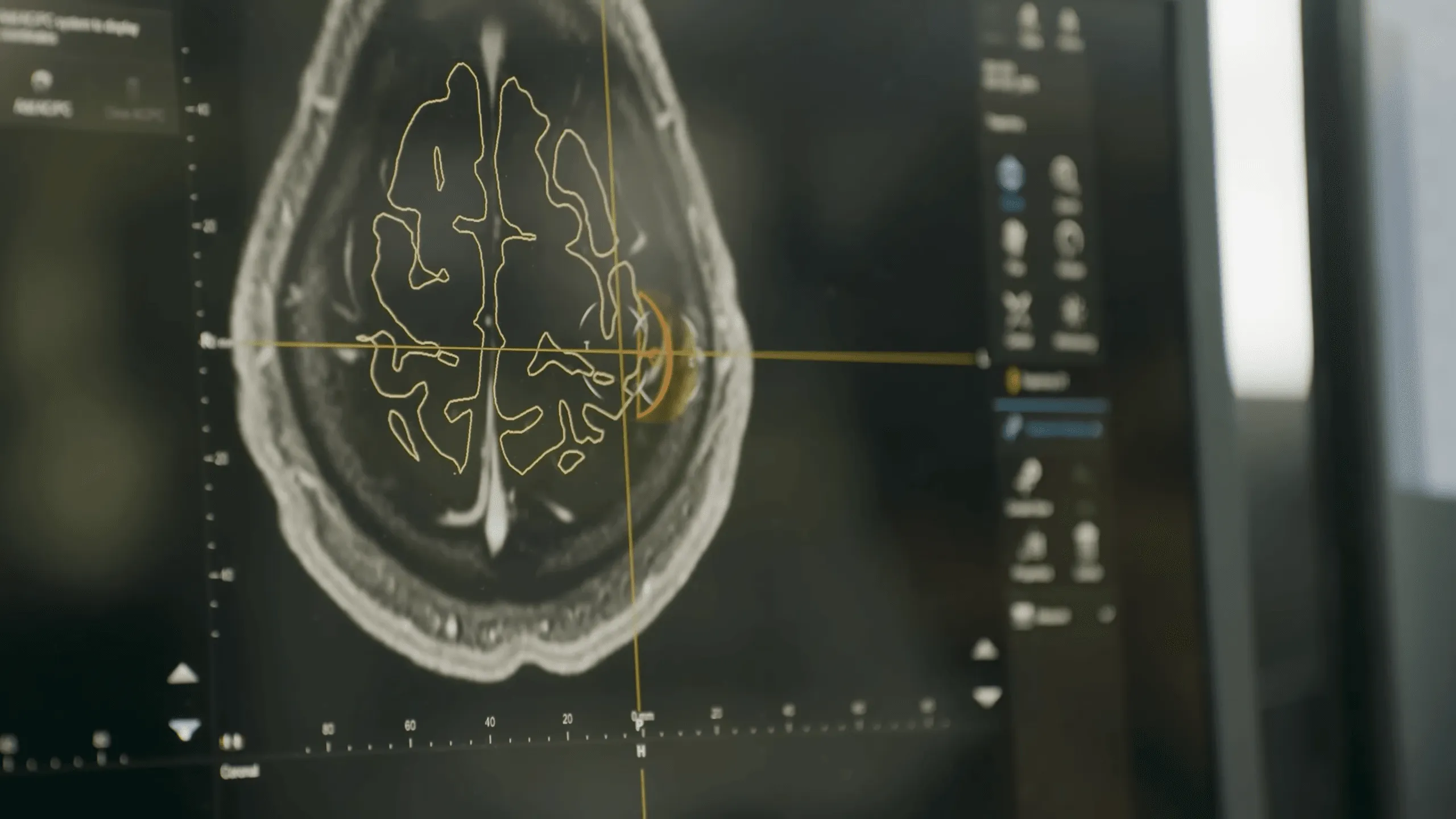 Neuralink、評価額90億ドルで6.5億ドル調達：脳とAIの融合加速