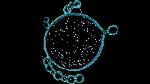 新たに発見された奇妙な微生物が、複雑な生命の起源を解明する手がかりとなるかもしれない